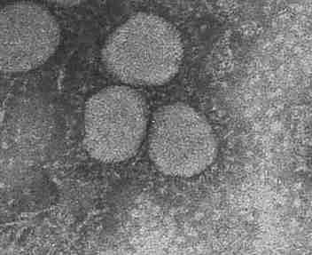 Coronavirus In Nigeria