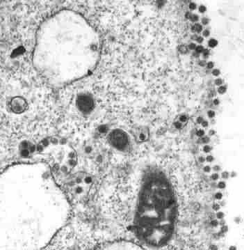 Coronavirus In Nigeria