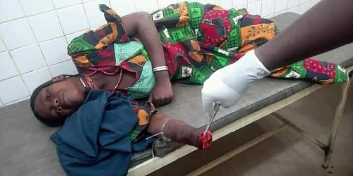 Police Arrest Man For Cutting Off Wife'S Hand In Yobe