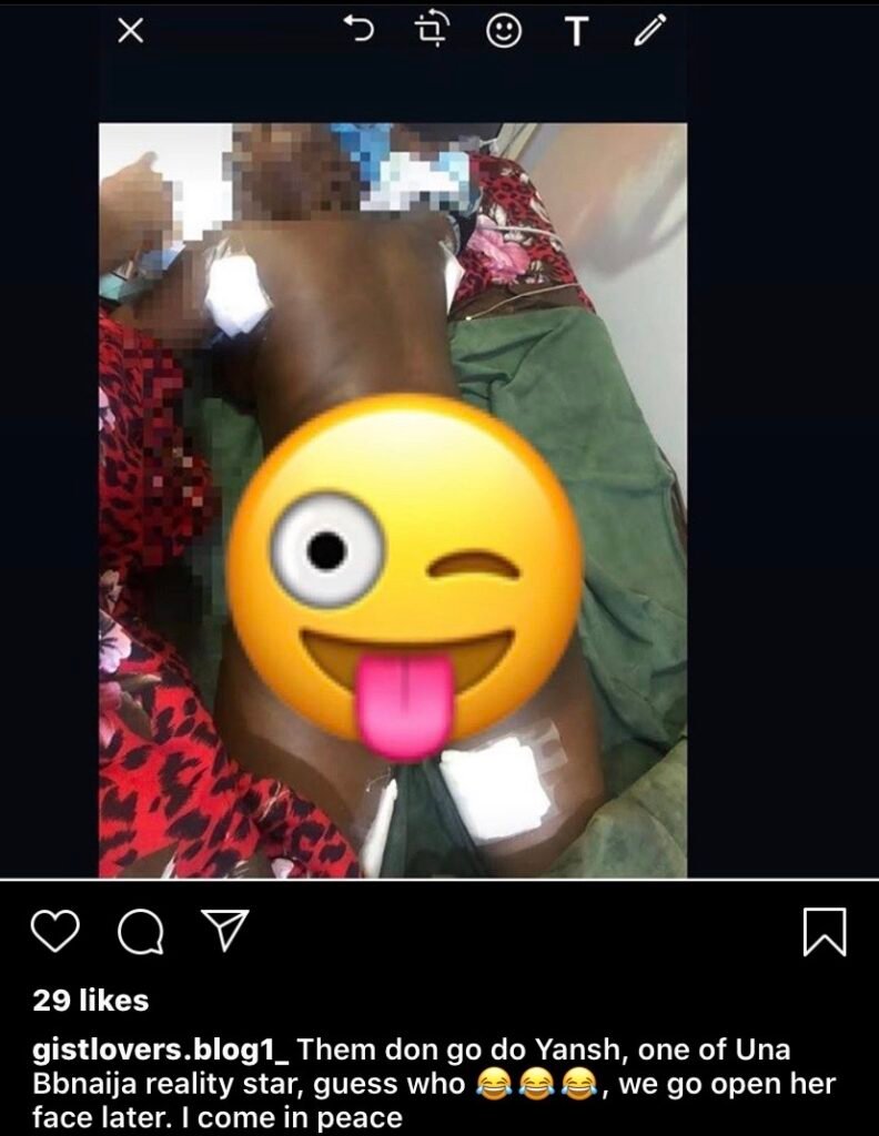 Disturbing Liposuction Gone Wrong Picture Of Suspected Ex-Bbnaija Housemate Trends On Instagram