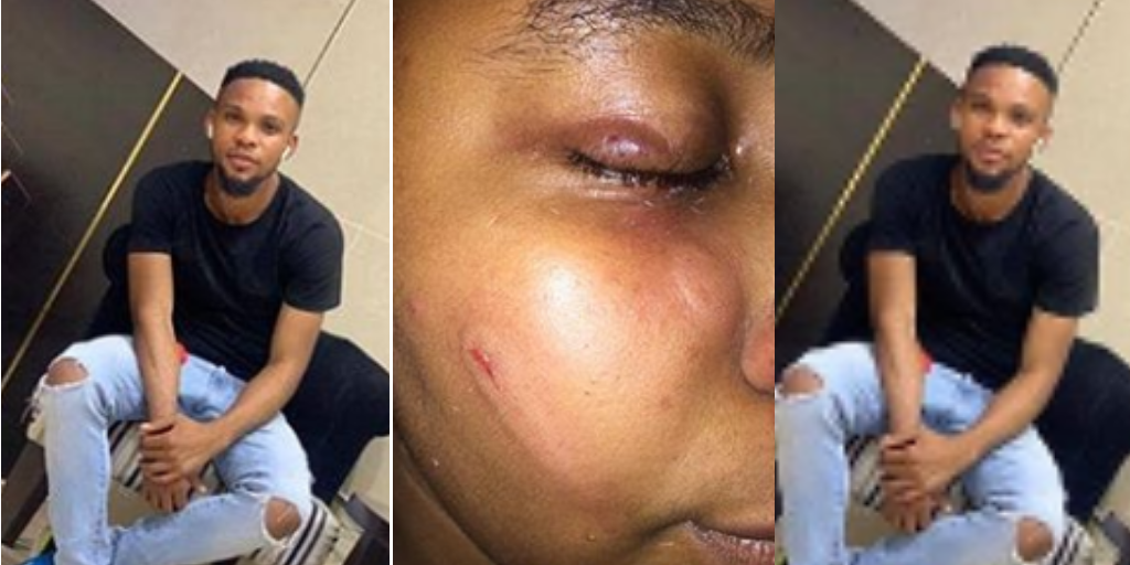 Man Beats Girlfriend