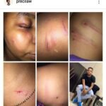 Man Allegedly Beats Girlfriend For Demanding Money From Mother