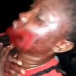 New Details About Police Officer Who Shot Lady'S Mouth In Lagos(Pic) Joy Eze