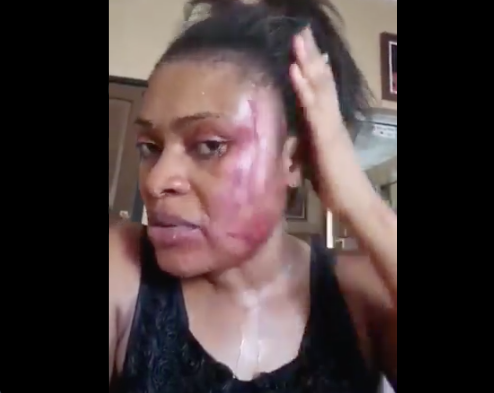 Channels Tv Reporter Allegedly Battered Wife