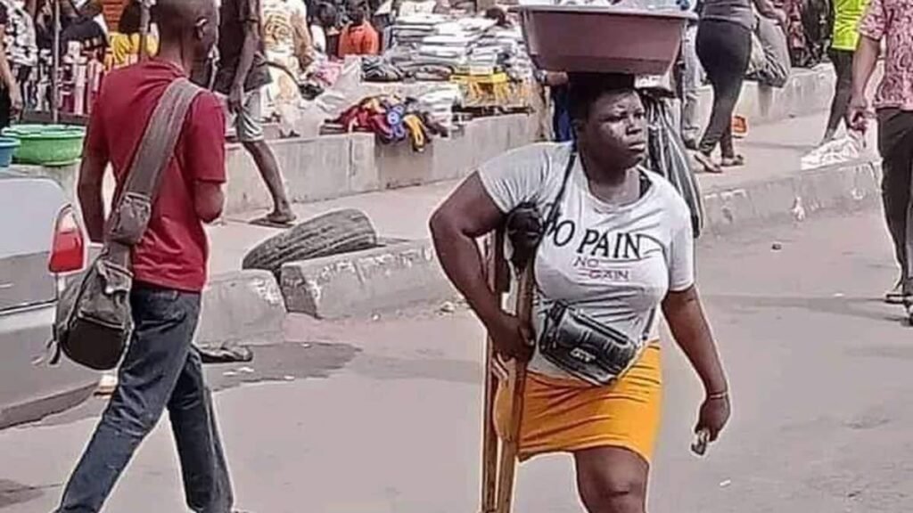 Revelations About Lagos Amputee Hawker Generate Reactions