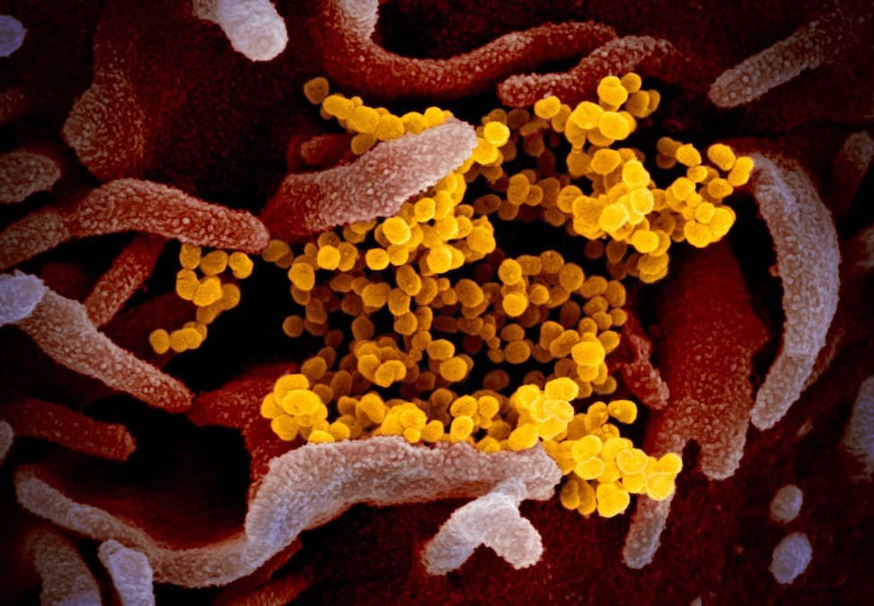 Scientists Discover New Type Of Coronavirus