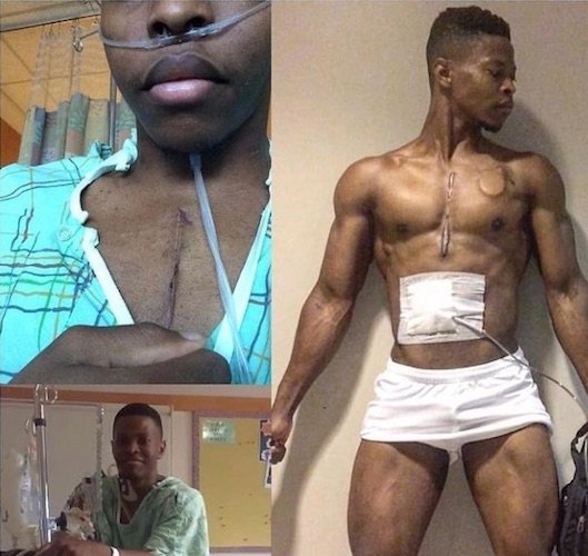 Meet Man With Rechargeable Heart