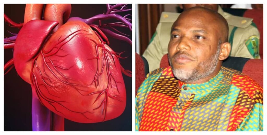 &Quot;Nnamdi Kanu'S Heart Has Enlarged By 13%&Quot; - Lawyer