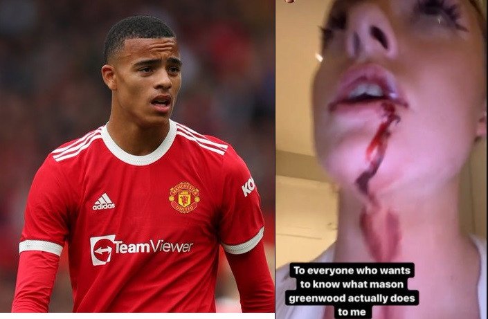 Mason Greenwood Gains Freedom As He Is Released