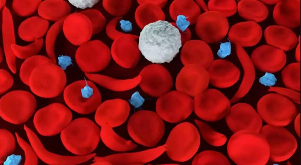 Surviving Sickle Cell Anemia In Nigeria Today