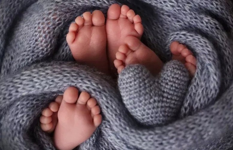 Update- Baby With 4 Legs:arms Seen As 'God' In India
