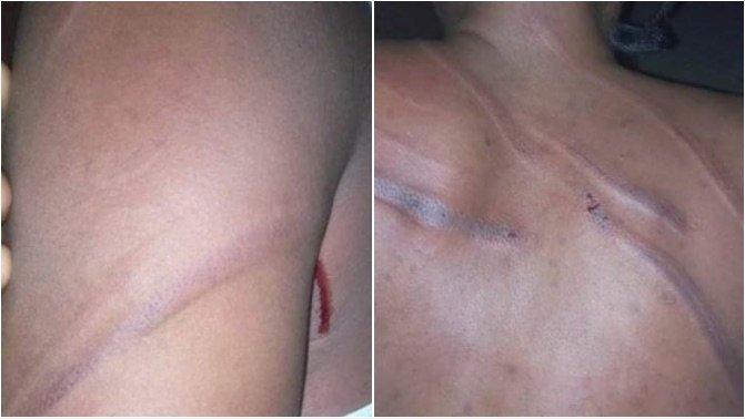 Domestic Violence: Woman Narrates How Her Husband Almost Killed Her