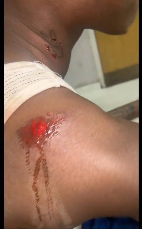 Mohbad Physically Assaulted By Record Label Boss
