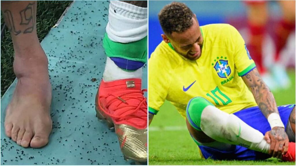 Neymar Might Miss The Rest Of The World Cup